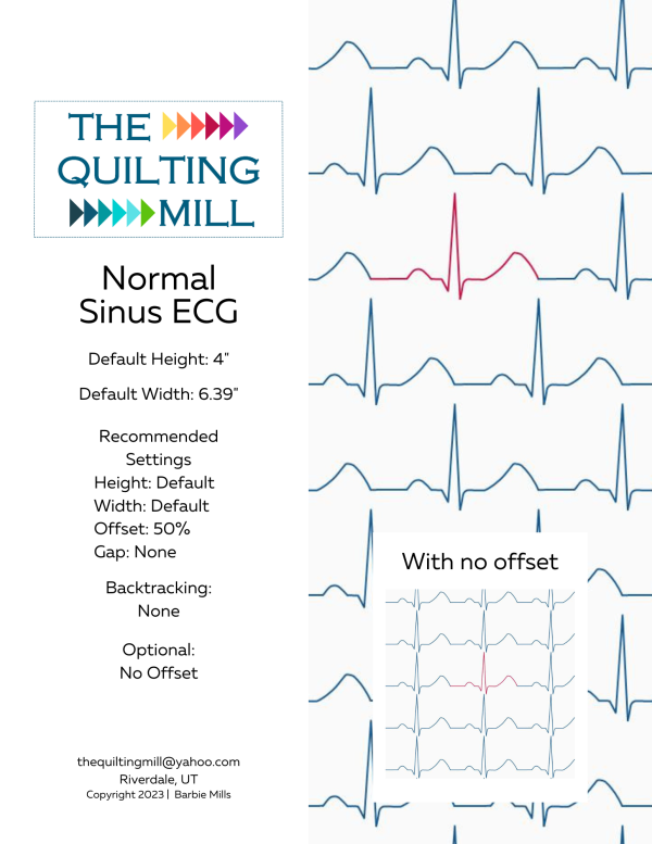 Normal Sinus ECG
