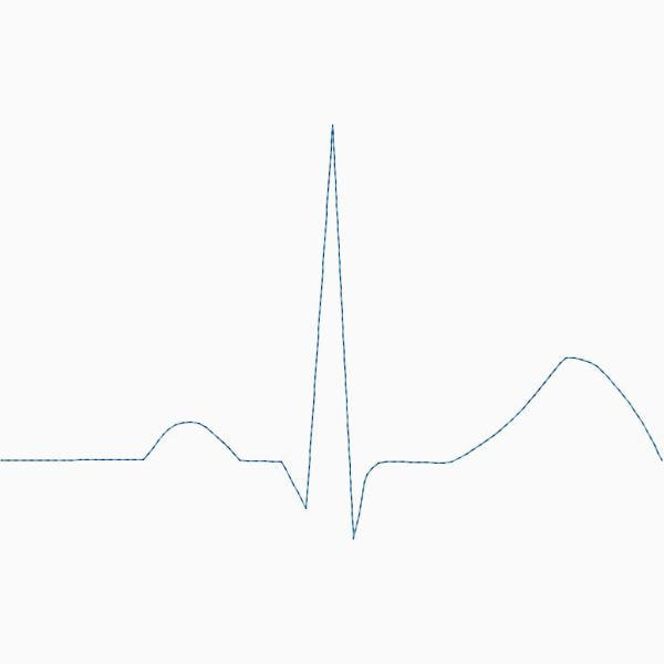 Normal Sinus ECG